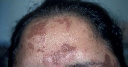 ghk-cu acne Neurogan Health, GHK-Cu Copper Peptide, Hair & Scalp Serum main image 1